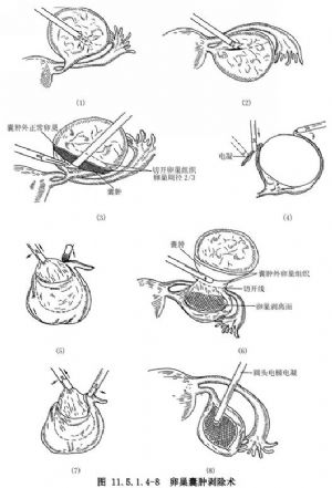 电凝钳行业发展深度调研与未来趋势预测行业竞争格局与主要企业_人保财险政银保 ,人保车险