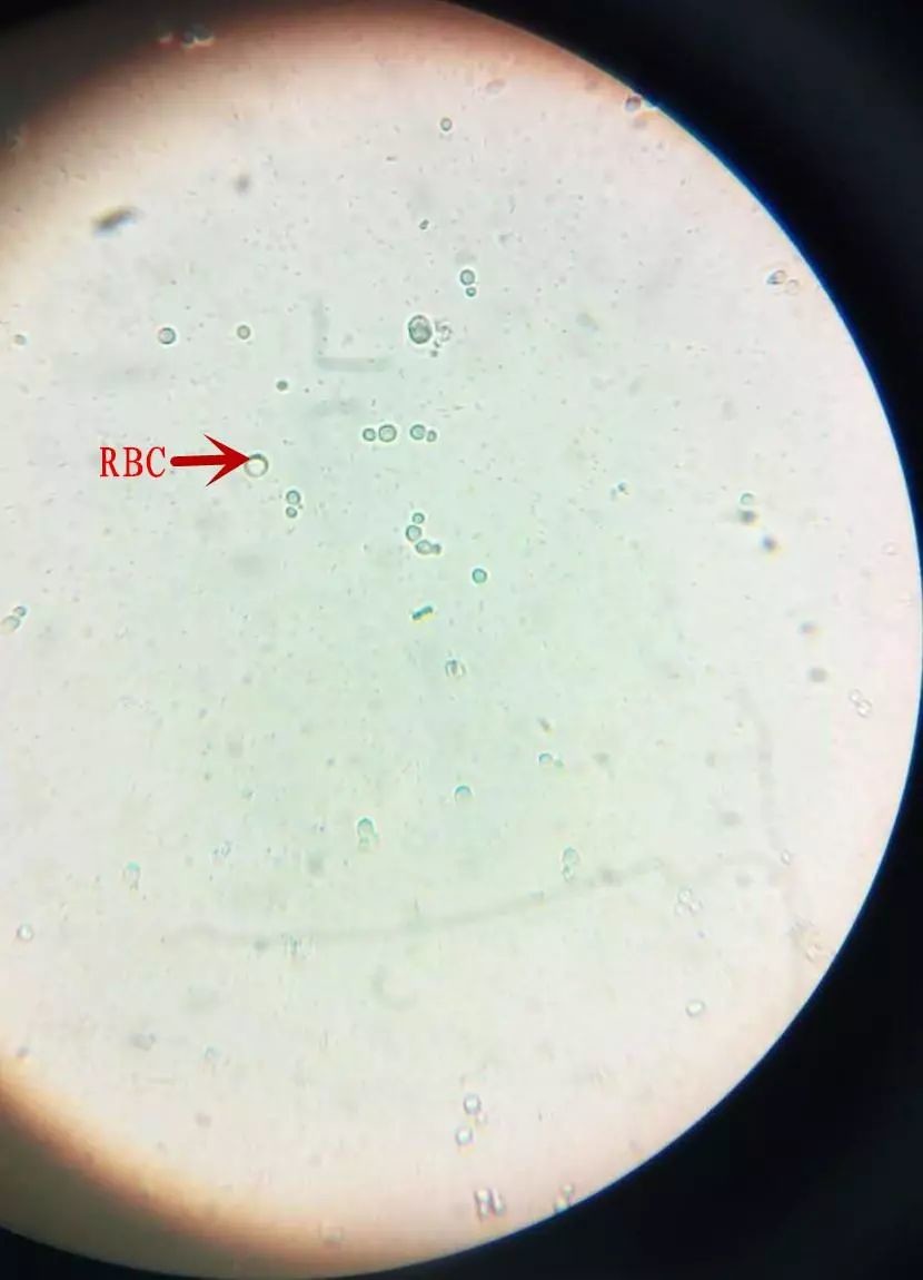 以色列科研人员“复活”80年前真菌标本
