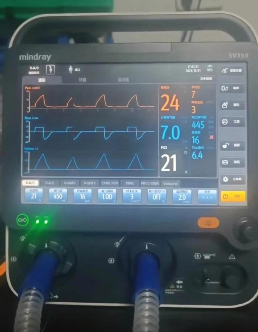 失速的医疗器械龙头迈瑞医疗：中报首现上市负增长，国内业务拖后腿，低价竞标挤压利润