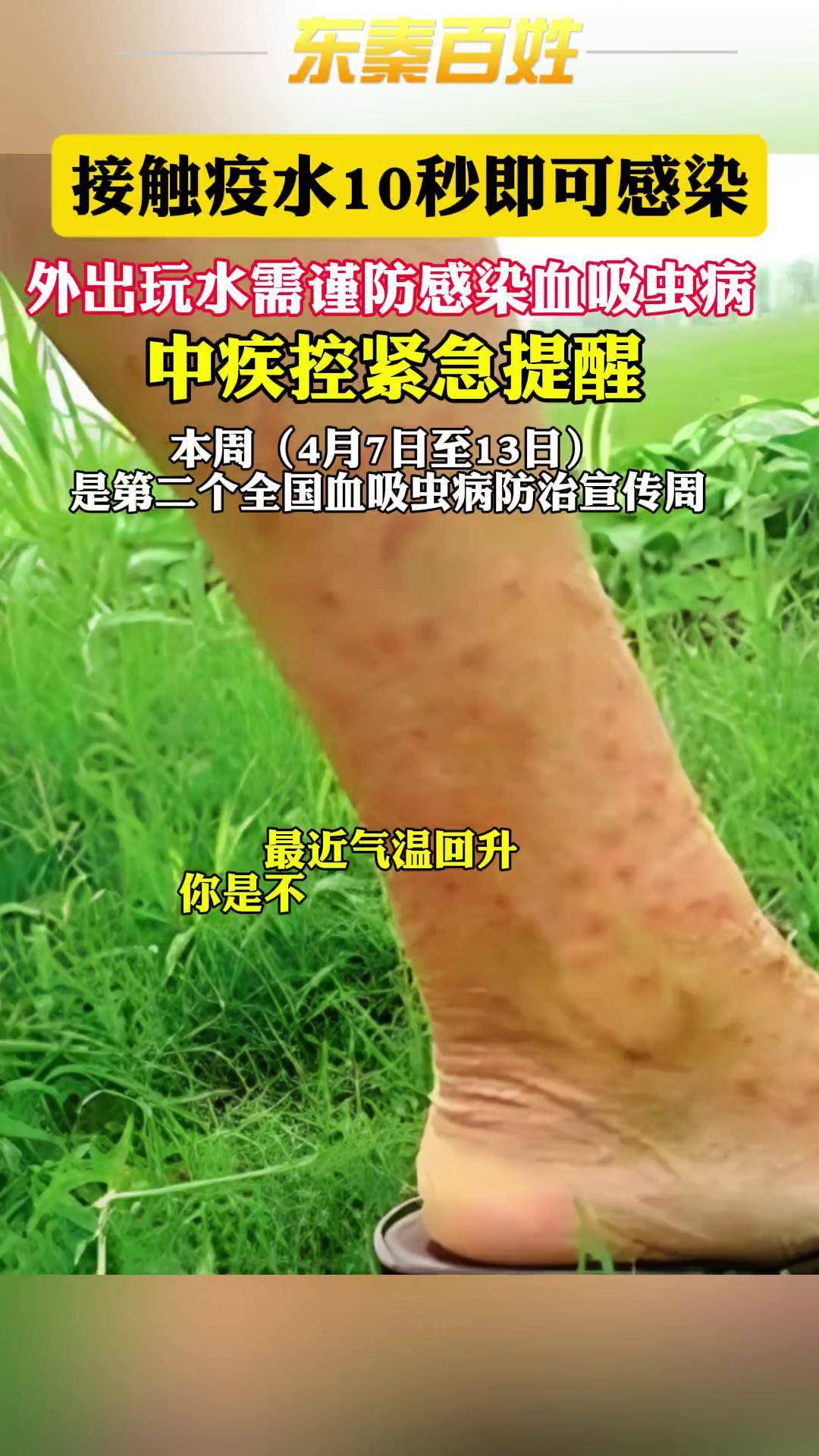 国家疾控局发布提醒！