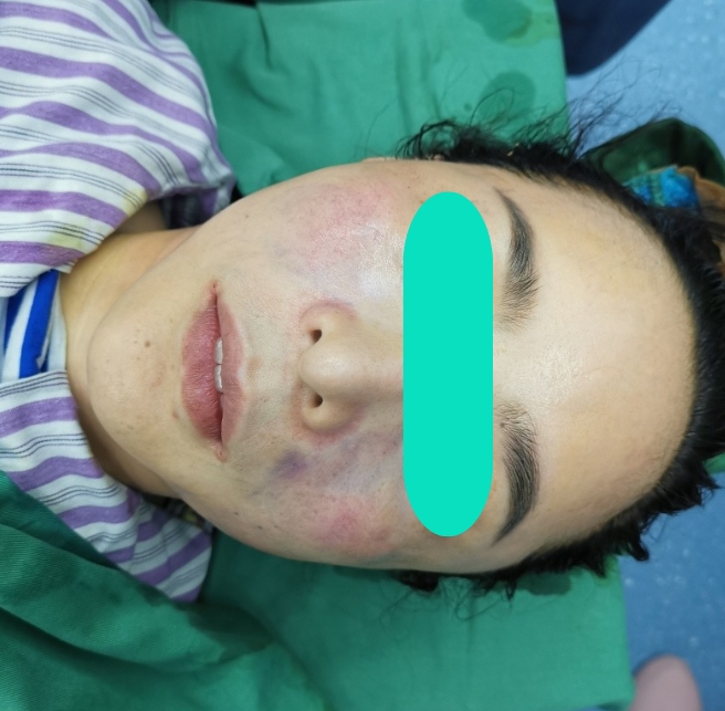 花5万元打的美容针，竟是修复骨缺损的骨科材料，约定注射的部位还没打就收费！美容所已被立案