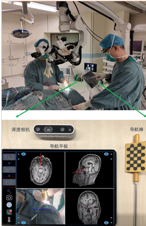 助力精准治疗 垂体腺瘤术前评估有了“AI诊断助理”
