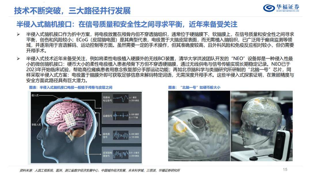 美好医疗：具备拓展脑机接口产品研发制造能力