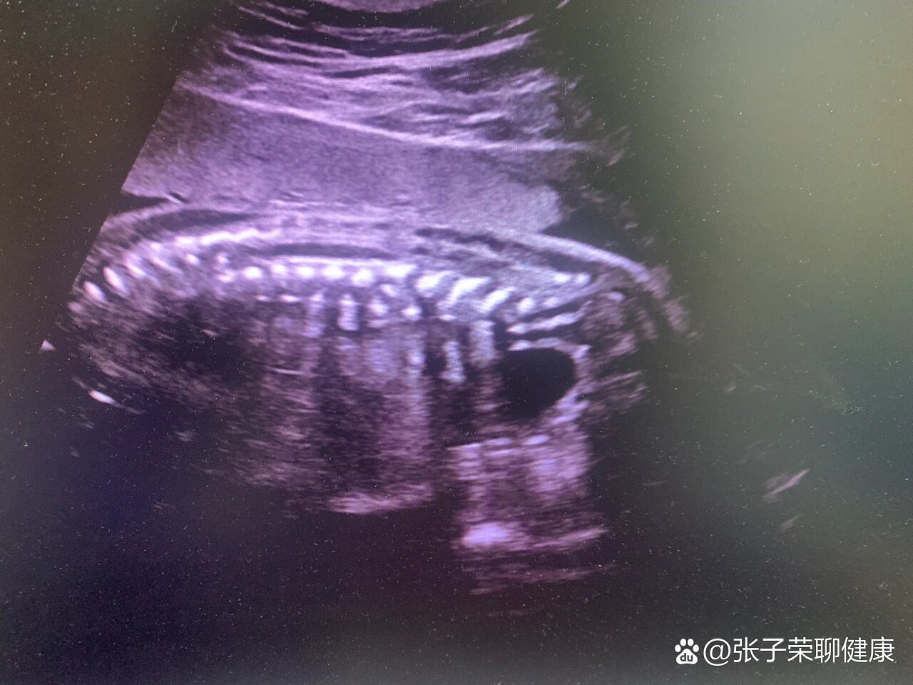 四维图新：PhiGo Max方案预留L3升级空间