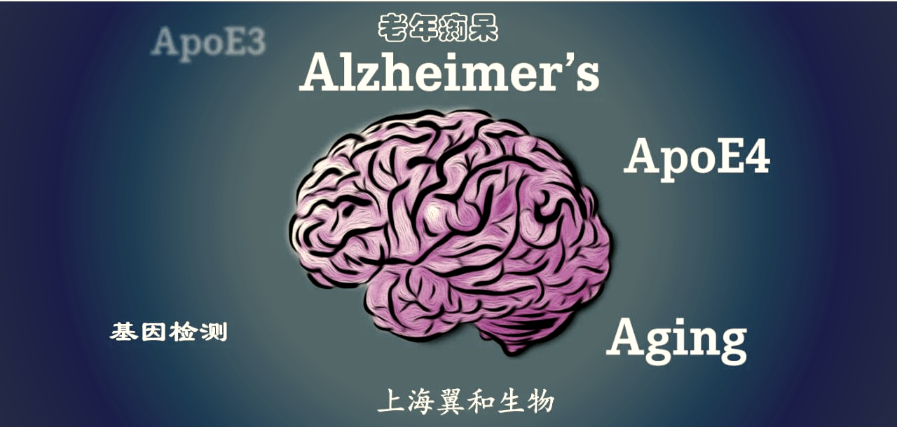 研究显示老人某些变化可能与痴呆症风险相关